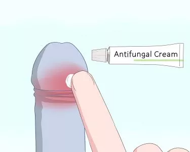 Penis Health - how to articles from wikiHow
