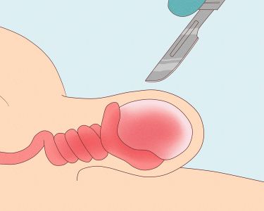 Penis Health - how to articles from wikiHow