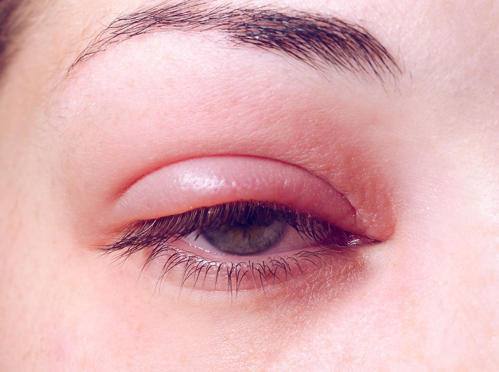 Eye Infection from Makeup: Everything You Need to Know