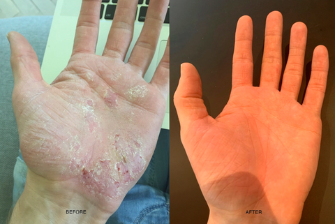How sulfates can impact your skin – woods_ copenhagen