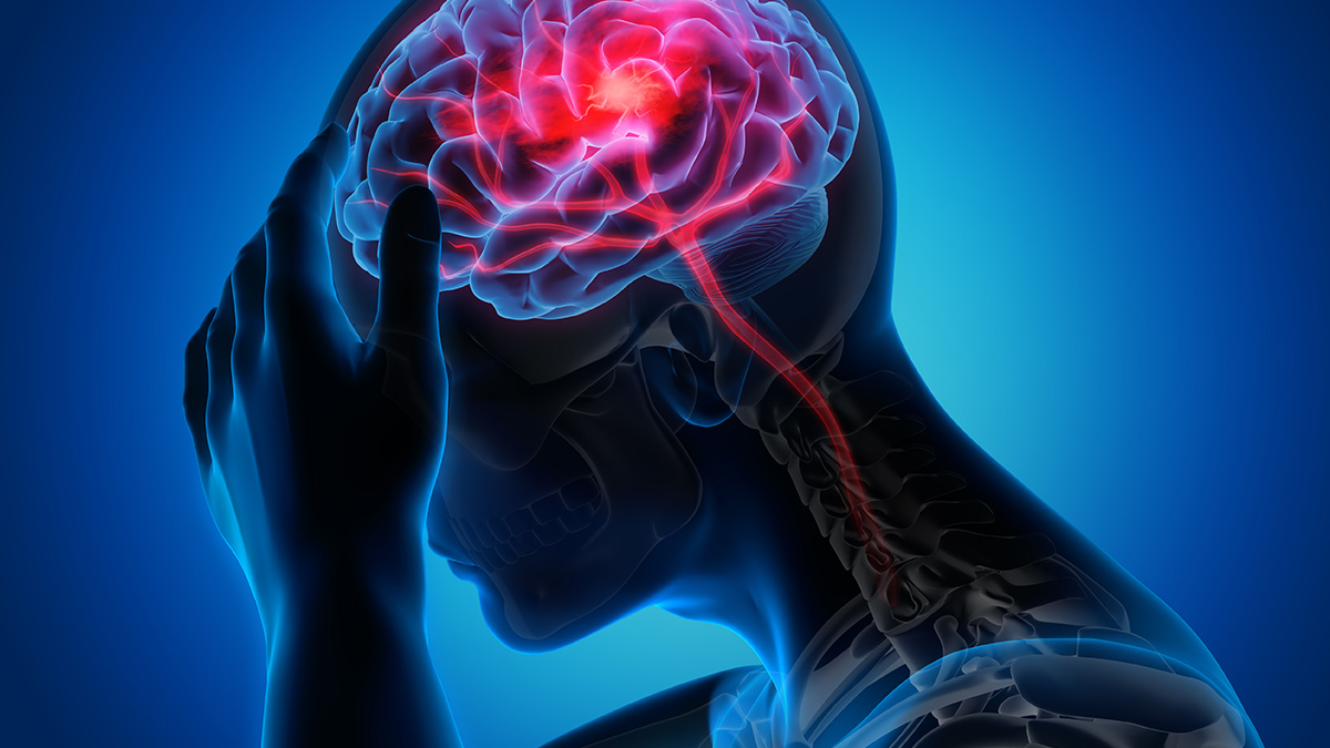 Signs and Symptoms of Stroke | Stroke | CDC