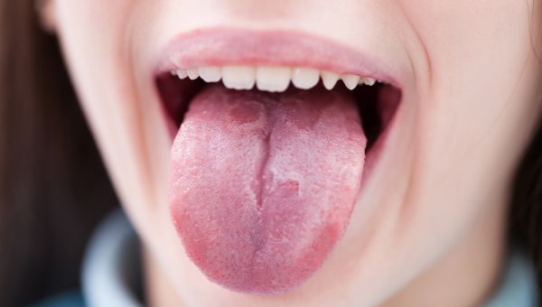 What your tongue reveals about your health | oral-health - Sharecare