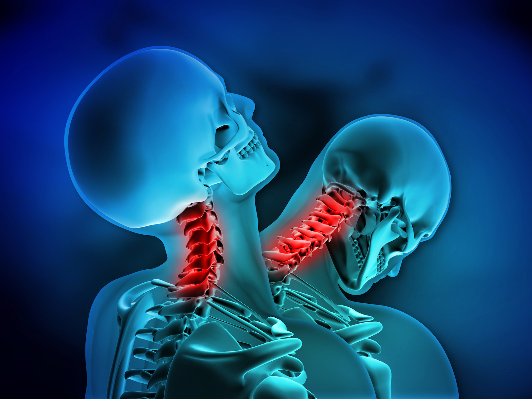 Why Does My Neck Hurt After a Car Accident?