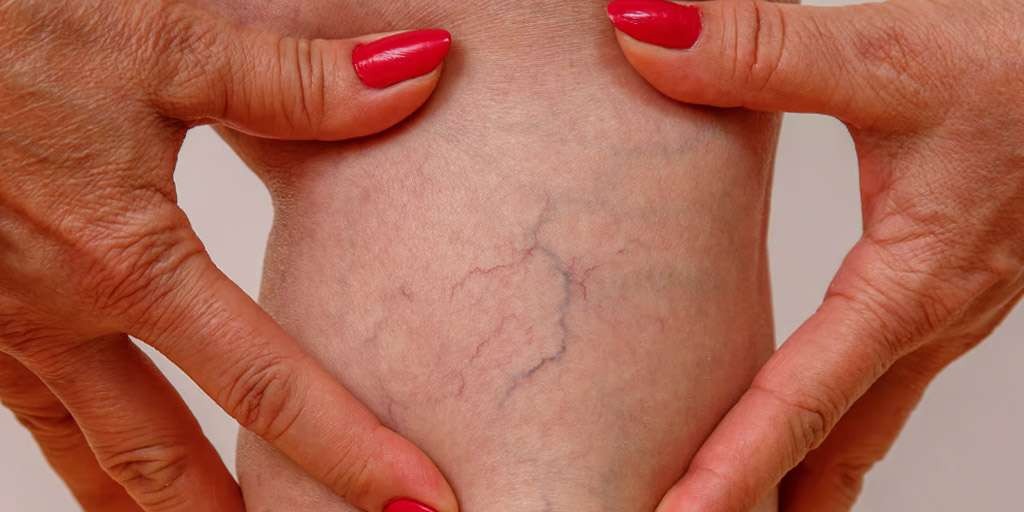 why-are-my-veins-blue-banner-1